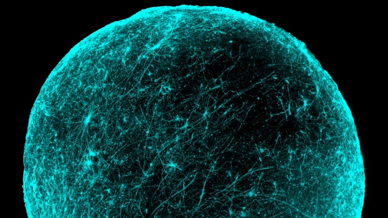 Contextual neural organoid imagery from Stanford’s Pașca Lab; not a figure from the 2017 paper.