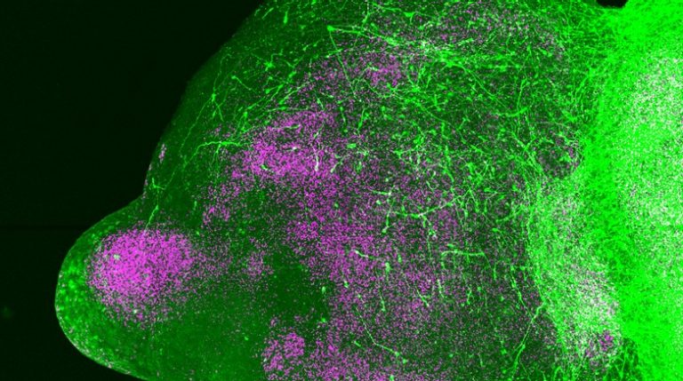 Contextual neural-cell microscopy from Stanford’s Pașca Lab; not a figure from this study.