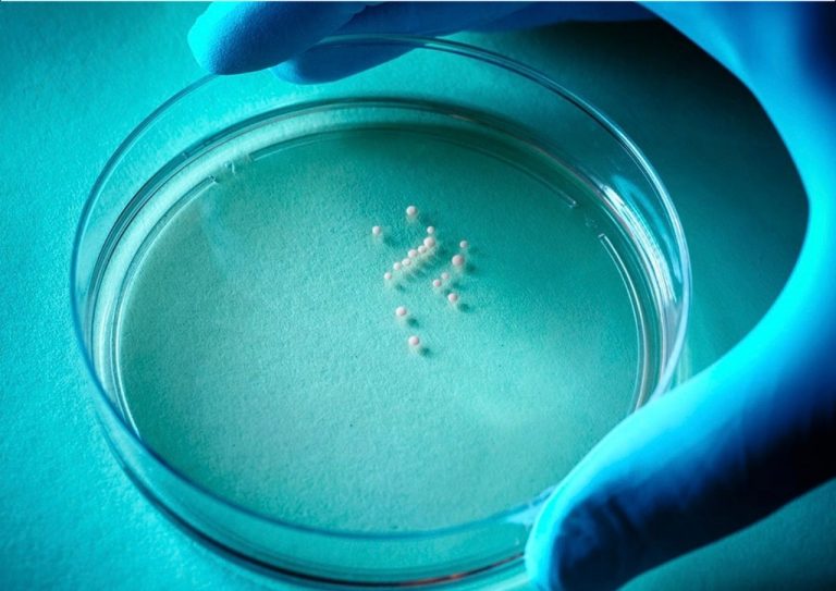 Brain organoids, featured by Stanford Medicine in its Timothy syndrome research report.